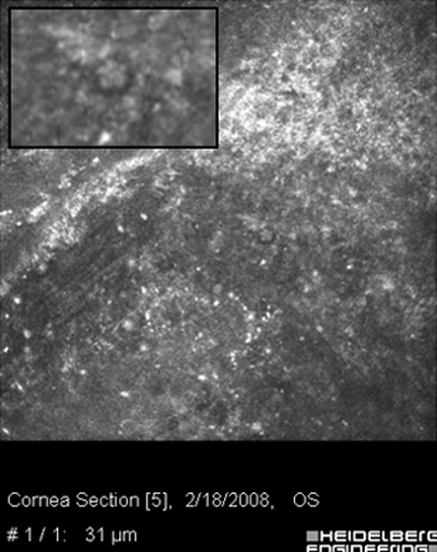 Comparar Microscopía Confocal